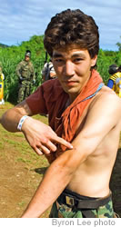 Kyle “Tweak” Arai shows off his battle scars